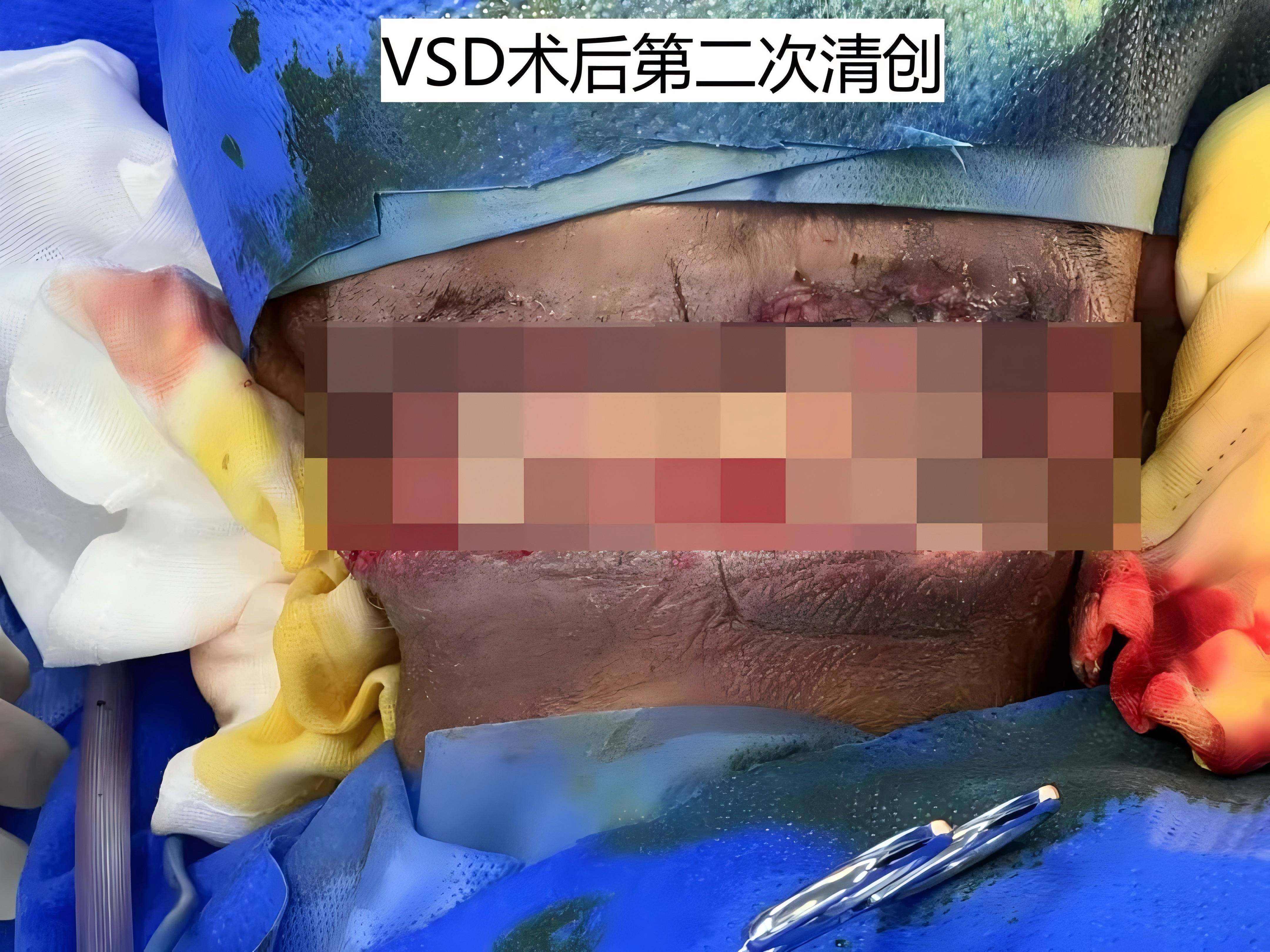 vsd第二次(1).jpg
